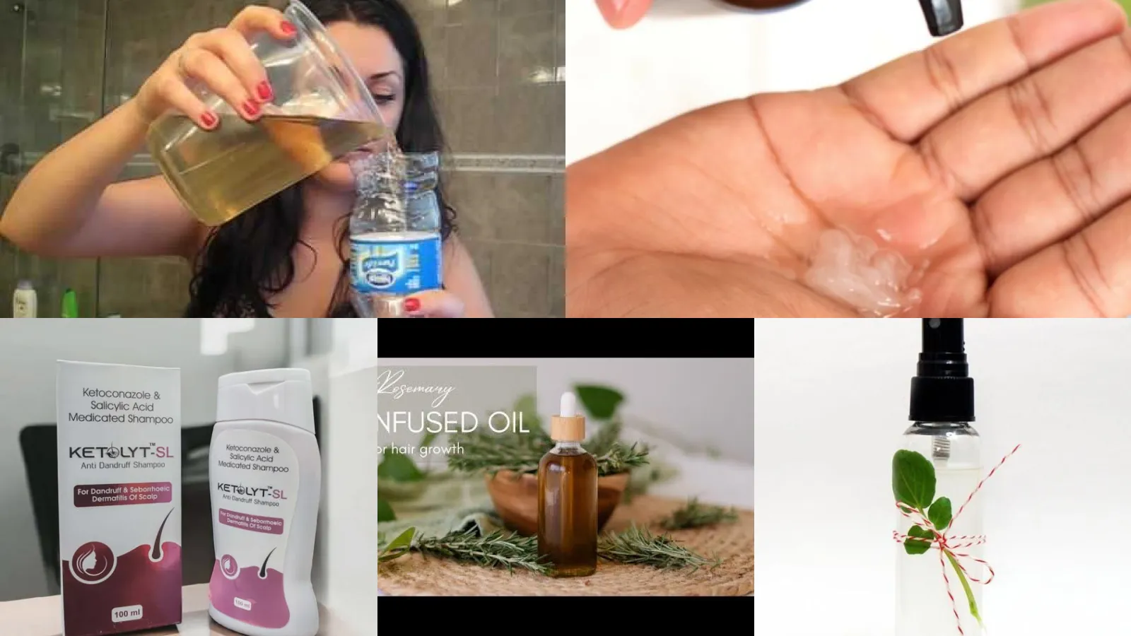 20+ Genius Remove Dandruff Home Healthy Scalp Worth Stealing